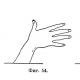 Мер, быстрое движение руки может вызывать нарушение равновесия